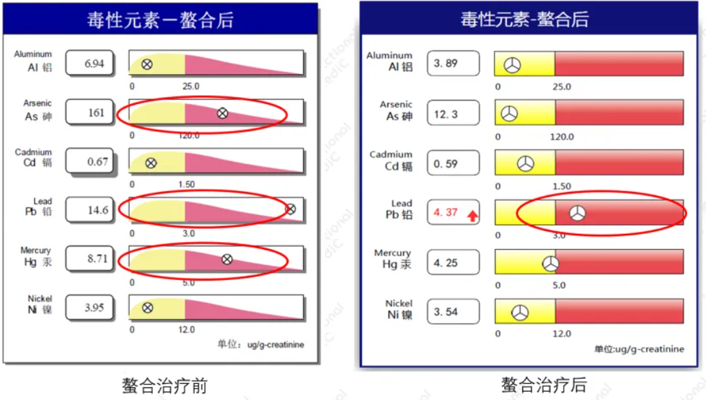 温故而知新专栏 | 解毒与生物转化失衡篇《重金属螯合案例分析》