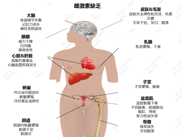 温故而知新专栏 | 雌激素代谢失衡的功能医学干预（上）